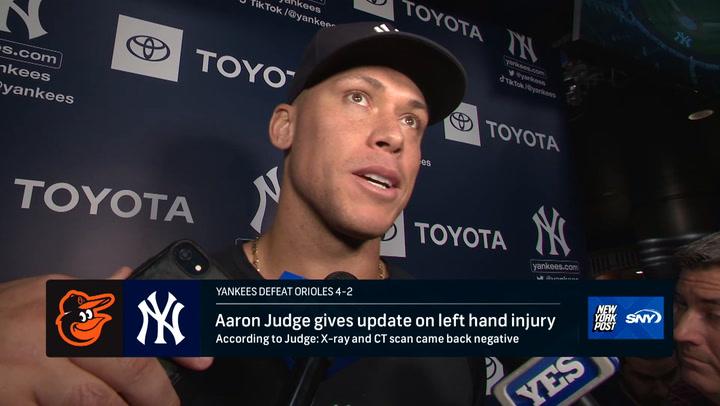 Aaron Judge has an injury update after being HBP