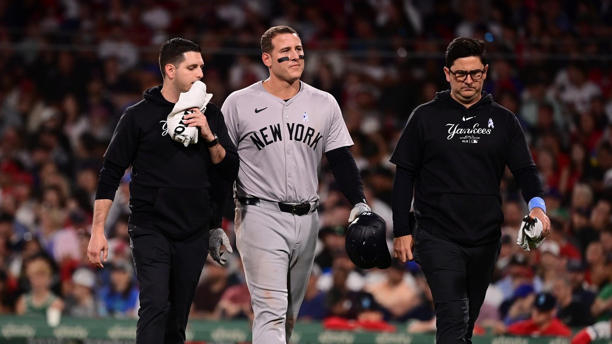 Yankees' Anthony Rizzo sustains arm fracture, could miss 4-to-6 weeks